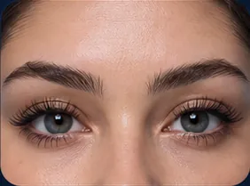 Natural
