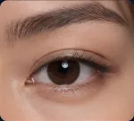 Double Eyelid