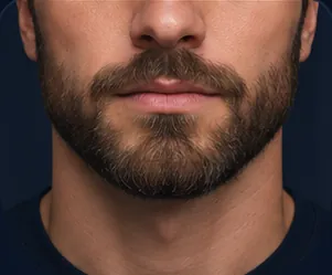 Short Beard