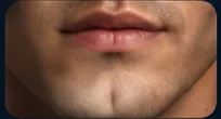 Cleft Chin