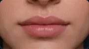 Medium