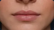 Thin