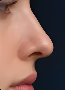 Caída