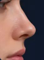 Natural