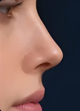 Refinada